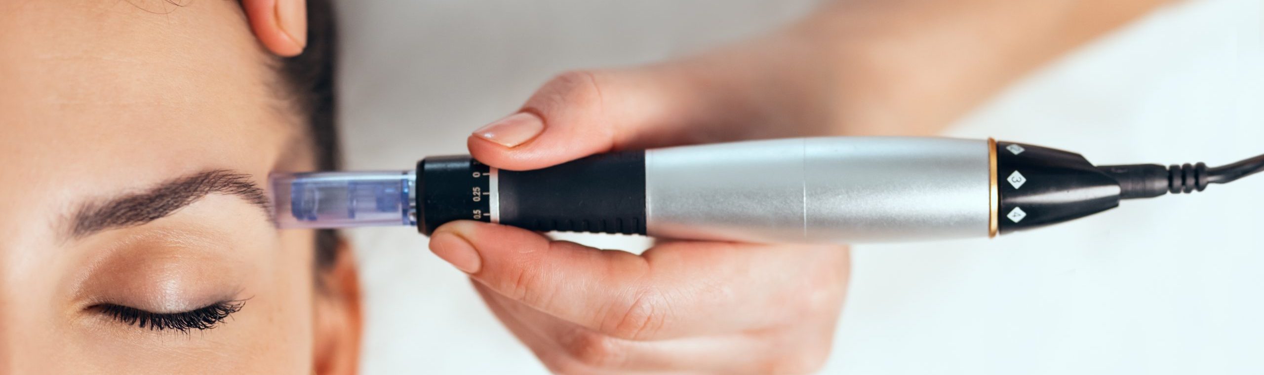 72a9c44c-3666-4053-ab36-a47b76945c8e Microneedling Behandeling