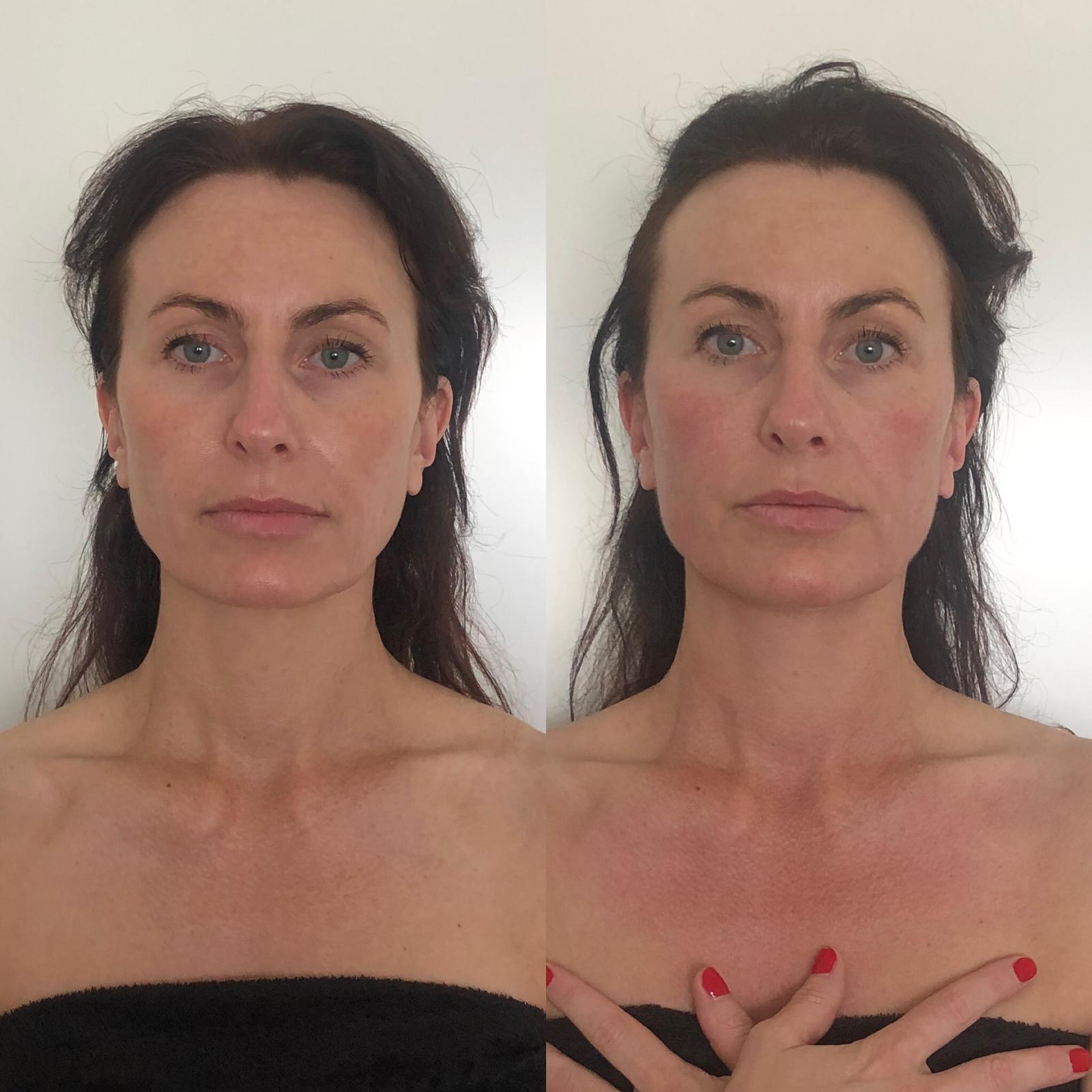 Buccal massage voorbeeld COSMETISCHE BINDWEEFSELMASSAGE VOOR HET GEZICHT