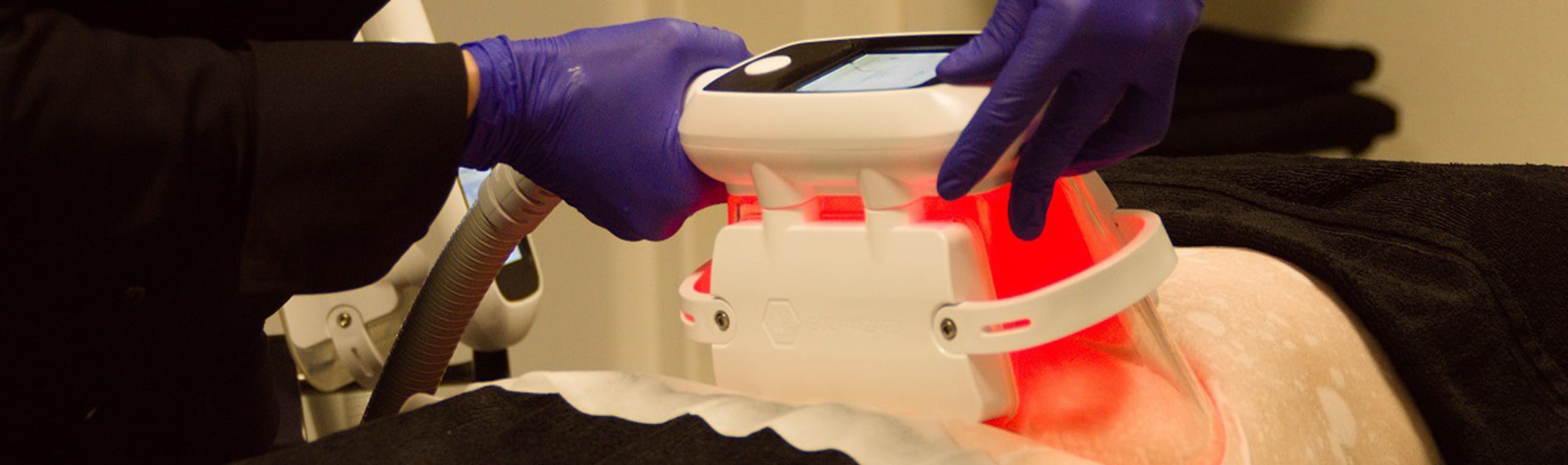 Foto cryolipolise_2 Cryolipolyse Behandeling