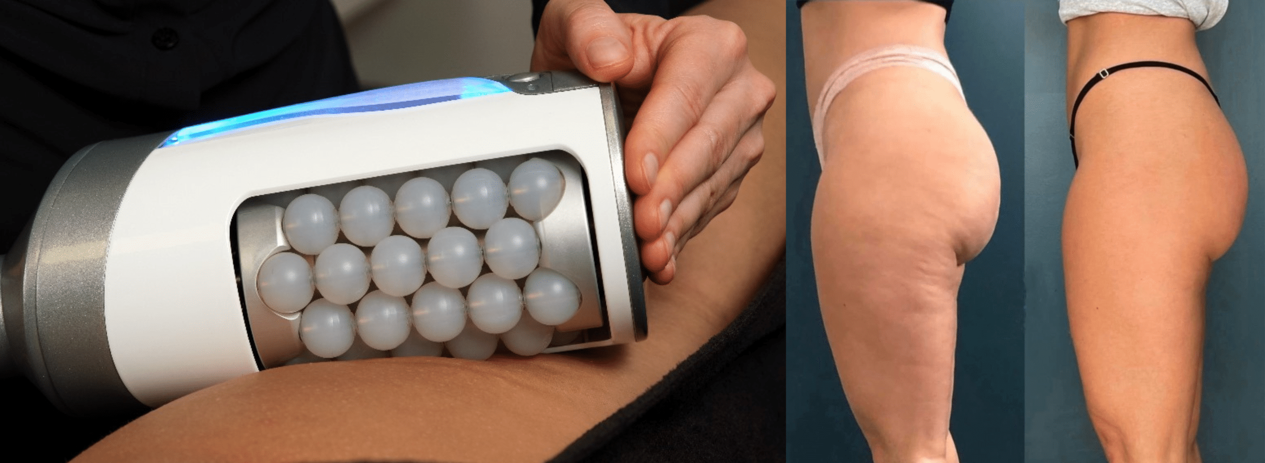 Endosheres Therapie
