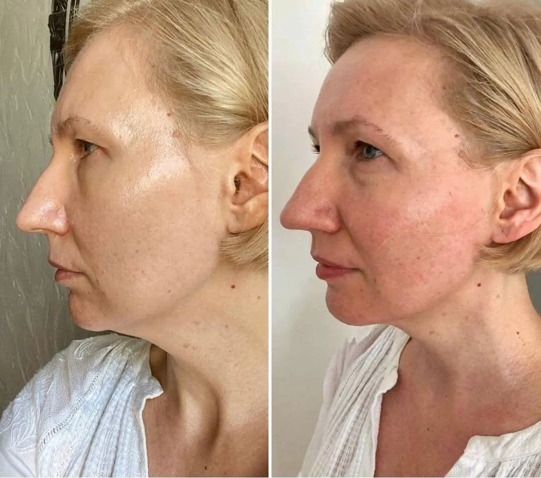 Ko Bi Do Japanse Massage